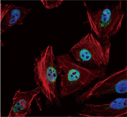 HDAC1 antibody  (GTX100513)