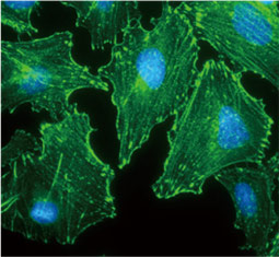 alpha Actinin 2 antibody (GTX103219)