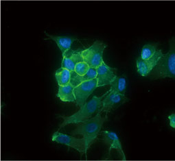 pan Cadherin antibody  (GTX132646)