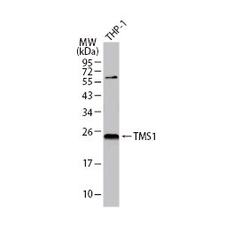 TMS1 antibody [N1C3](GTX102474)
