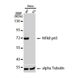 NFkB p65 antibody(GTX107678)