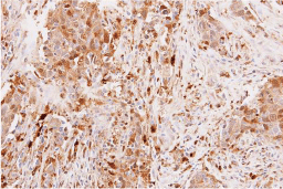Leptin antibody