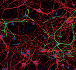 GFAP antibody