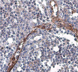 CD31 antibody
(GTX110602)