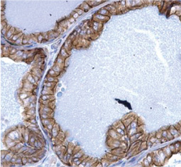 Cytokeratin 5 antibody
(GTX113219)