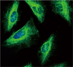 Vimentin antibody(GTX100619)