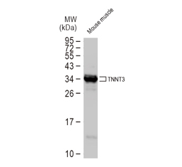 Troponin T fast skeletal antibody GTX130922