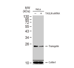 HEXIM1 antibody [N1C1] GTX102283