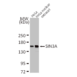 SIN3A antibody (GTX129156)