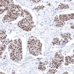 GATA3 antibody [MSVA-450M] HistoMAX (GTX04420)