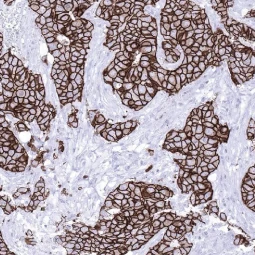 Her2 / ErbB2 antibody [MSVA-340R] HistoMAX™ (GTX04428)