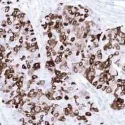 Mammaglobin A antibody [MSVA-457R] HistoMAX (GTX04406)