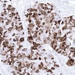 Mammaglobin A antibody [MSVA-457R] HistoMAX™ (GTX04406)