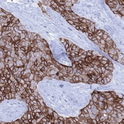 TACSTD2 antibody [MSVA-733R] HistoMAX™ (GTX04443)