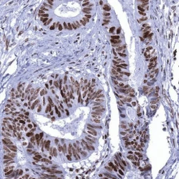 MSH6 antibody [MSVA-906R] HistoMAX™ (GTX04416)