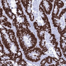 SATB2 antibody [MSVA-702R] HistoMAX™ (GTX04414) 