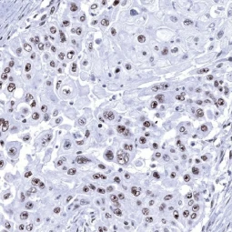 Nucleolin antibody [MSVA-623R] HistoMAX (GTX04456)