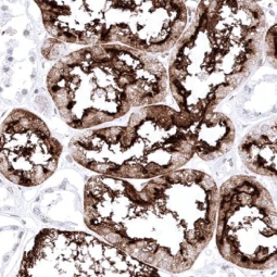 ACE2 antibody [MSVA-919R] HistoMAX™ (GTX04425)