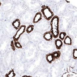 MUC1 antibody [MSVA-672R] HistoMAX (GTX04397)