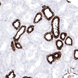 MUC1 antibody [MSVA-672R] HistoMAX™ (GTX04397)
