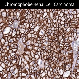 CDH16 antibody [MSVA-516R] HistoMAX™ (GTX04455)