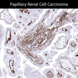 Collagen IV antibody [MSVA-704R] HistoMAX™ (GTX04434)