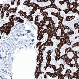 Hepatocyte Specific Antigen antibody [MSVA-OCE5] HistoMAX (GTX04478)