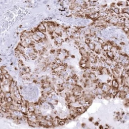 Napsin A antibody [MSVA-555R] HistoMAX (GTX04366)