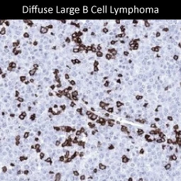 CD3 epsilon antibody [MSVA-003R] HistoMAX™ (GTX04389)