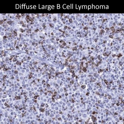 CTLA4 antibody [MSVA-152R] HistoMAX™ (GTX04439)