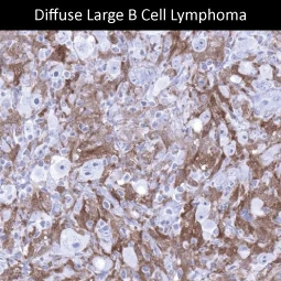 Factor XIIIa antibody [MSVA-813R] HistoMAX™ (GTX04452)