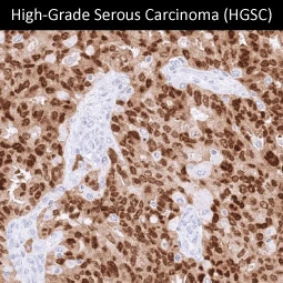PAX8 antibody [MSVA-708R] HistoMAX™ (GTX04430)