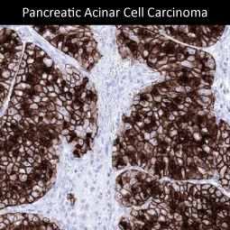 GP2 antibody [MSVA-475M] HistoMAX™ (GTX04436)