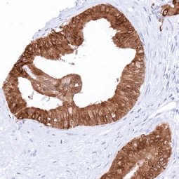 TFF1 antibody [MSVA-482M] HistoMAX™ (GTX04488)
