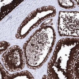 Prostatic Acid Phosphatase antibody [MSVA-452M] HistoMAX™ (GTX04396)