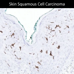 CD1a antibody [MSVA-001M] HistoMAX™ (GTX04407)