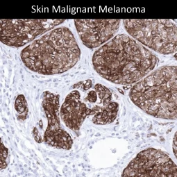 Melan A antibody [MSVA-901M+] HistoMAX™ (GTX04384)