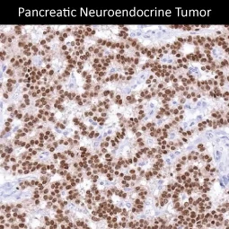 PAX6 antibody [MSVA-706M] HistoMAX™ (GTX04487)