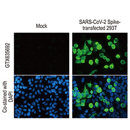 SARS-CoV-2 (COVID-19) nucleocapsid antibody [HL249]