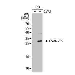 Coxsackievirus A6 VP2 antibody (GTX132348)