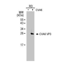 Coxsackievirus A6 VP3 antibody (GTX132689)