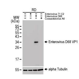 Enterovirus D68 VP1 antibody [HL1997] (GTX637898)