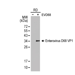 Enterovirus D68 VP1 antibody [GT11610] (GTX633688)