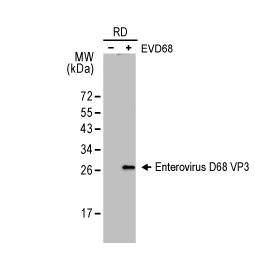 Enterovirus D68 VP3 antibody [GT1665] (GTX633706)