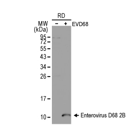 Enterovirus D68 2B antibody (GTX134419)