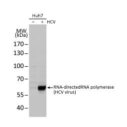 Hepatitis C Virus NS5B protein antibody