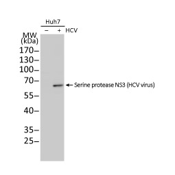 Hepatitis C Virus NS3 protein antibody