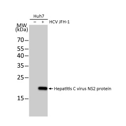 Hepatitis C virus NS2 protein antibody