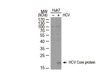 Hepatitis C Virus Core Antigen antibody