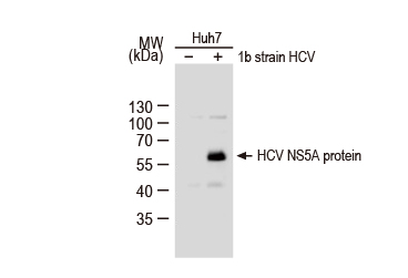 Hepatitis C Virus NS5A protein antibody